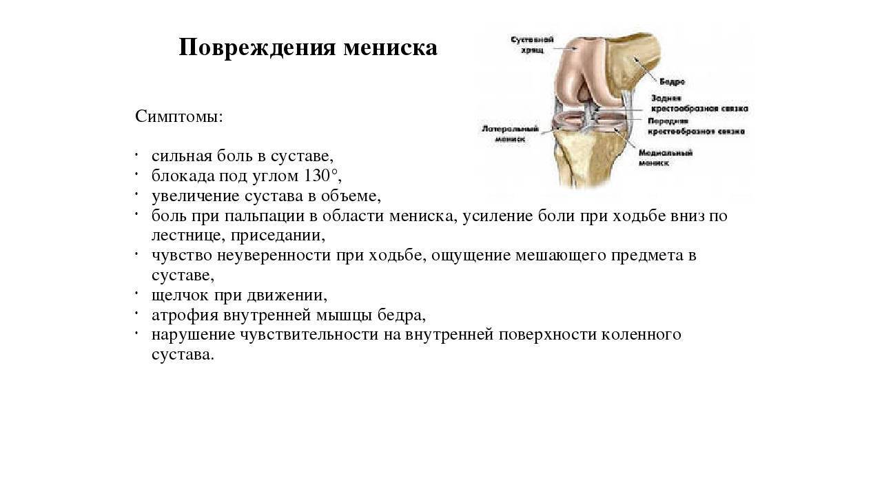 Лечение разрыва мениска коленного. Внешние симптомы повреждения мениска коленного сустава. Для повреждения мениска коленного сустава характерен симптом кача. Повреждение мениска колена симптомы. Симптомы повреждения колена.
