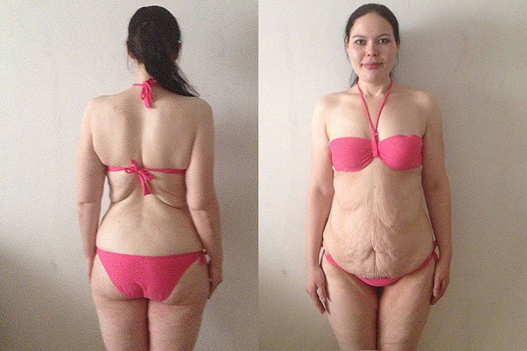 Упражнения для подтяжки груди: результат за 3 месяца