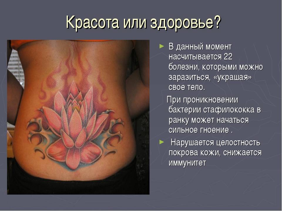 Татуировки у подростков: мнения медиков и юристов - отношения - info.sibnet.ru
