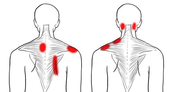 Тянущая боль в спине и шее является тревожным знаком того, что нужно срочно приниматься за лечение