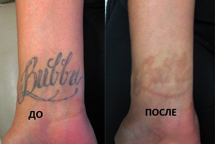Почему люди делают татуировки: психология «синей болезни»