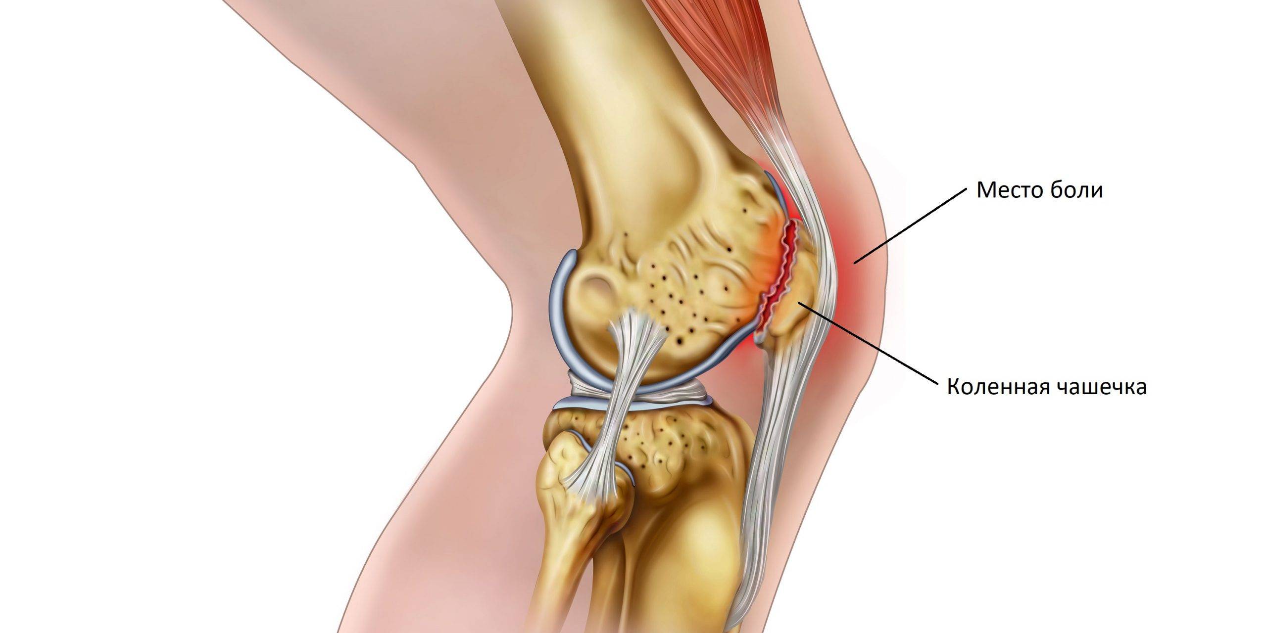 Боль в колене. почему болит колено?| ortoped-klinik.com