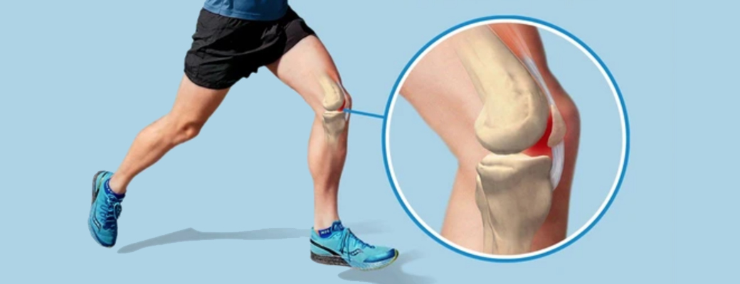 Почему болят колени после бега и что делать, чтобы снять боль
почему болят колени после бега и что делать, чтобы снять боль