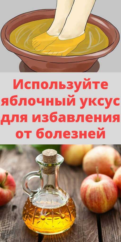 Яблочный уксус для похудения - 7дней.ру