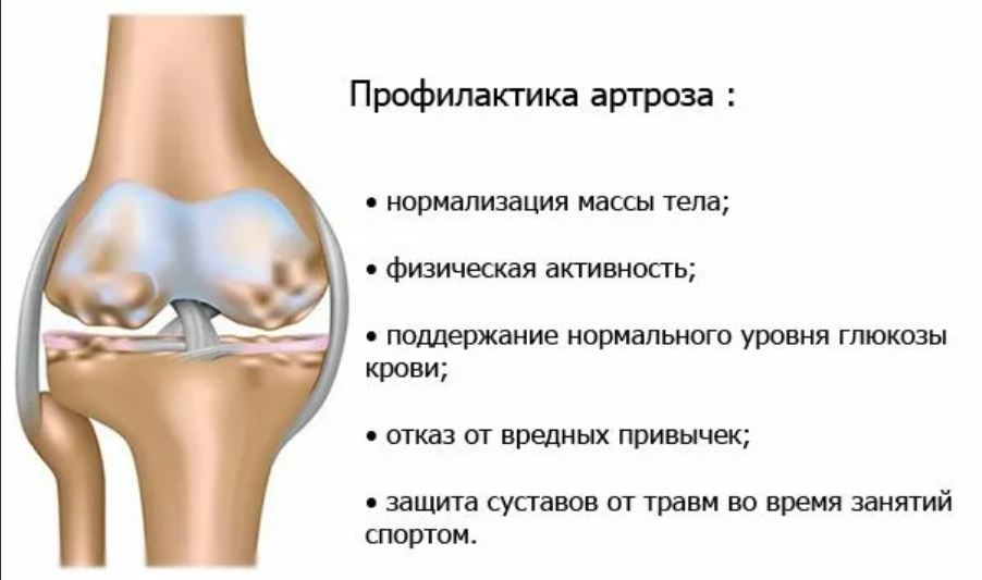 Seo-заголовок: боль и хруст в колене при приседании, вставании, ходьбе, сгибании причины, лечение народными средствами