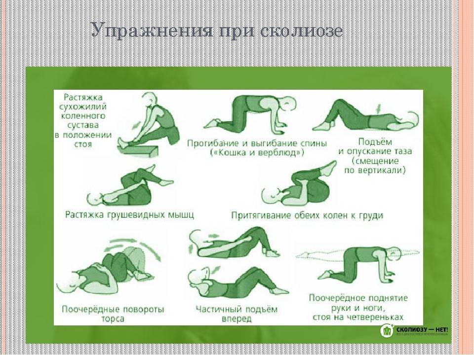 Упражнения для лечения сколиоза
