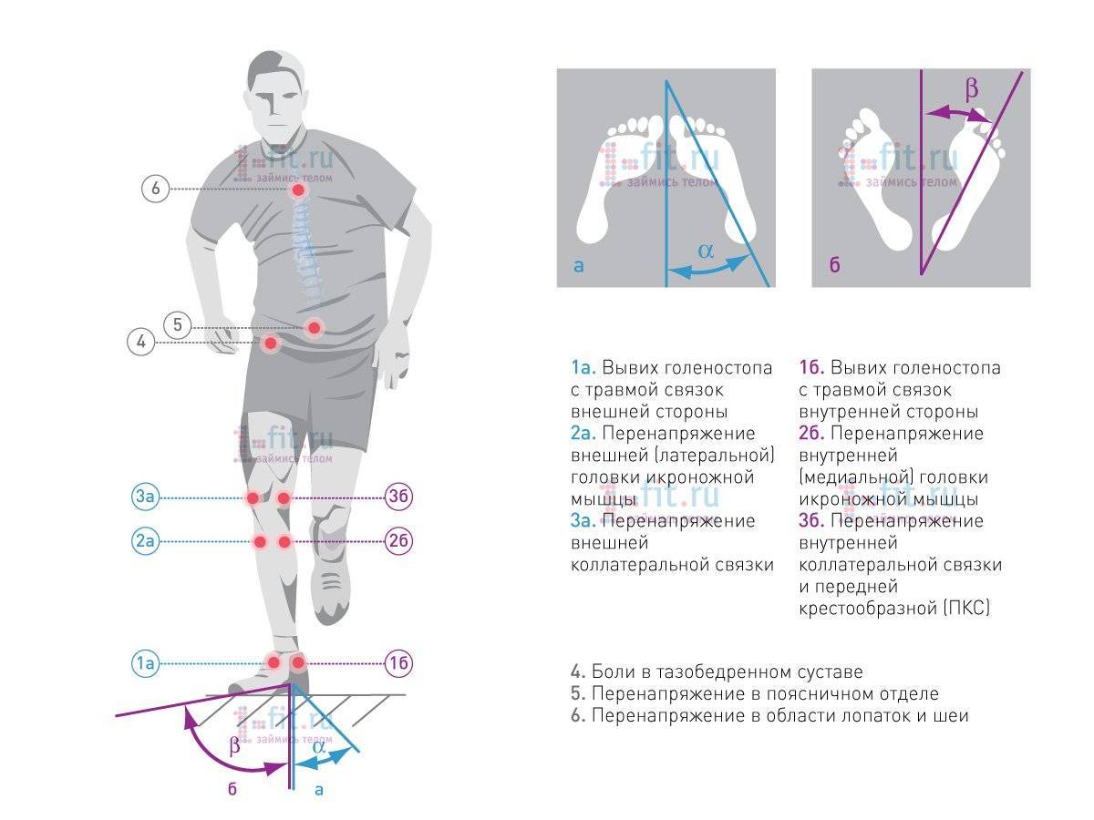 Гимнастика для коленных суставов: упражнения, правила, эффективность
