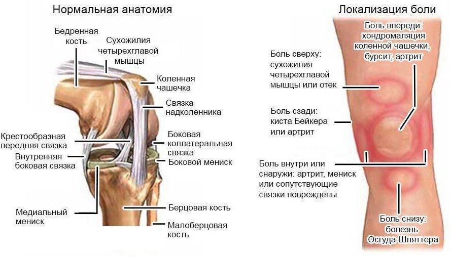 4 причины боли в коленях после бега. как исправить и предотвратить.
