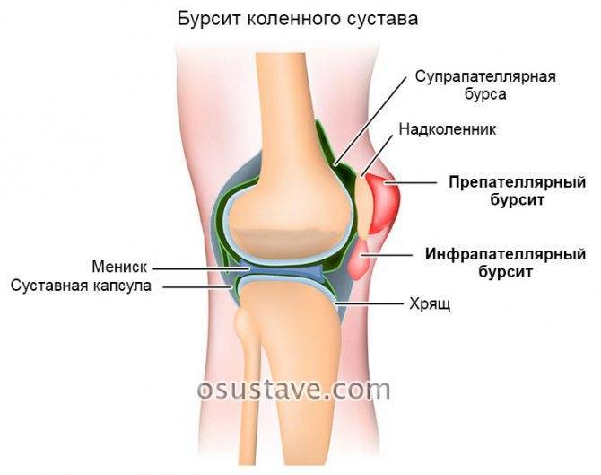 8 упражнений от хруста в коленях - noltrexsin